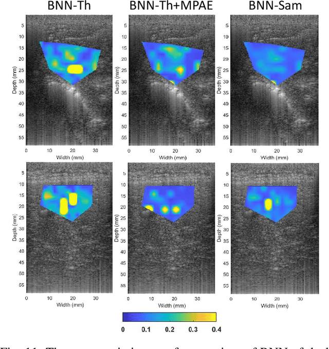 Figure 3 for Homodyned K-Distribution Parameter Estimation in Quantitative Ultrasound: Autoencoder and Bayesian Neural Network Approaches