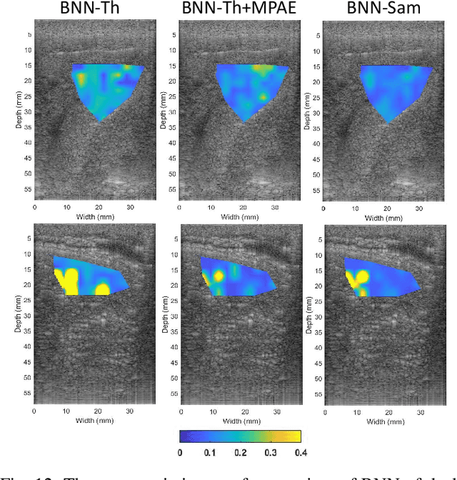 Figure 4 for Homodyned K-Distribution Parameter Estimation in Quantitative Ultrasound: Autoencoder and Bayesian Neural Network Approaches