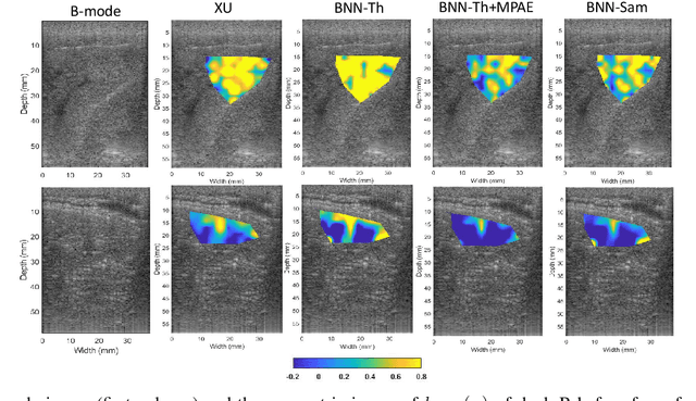 Figure 2 for Homodyned K-Distribution Parameter Estimation in Quantitative Ultrasound: Autoencoder and Bayesian Neural Network Approaches