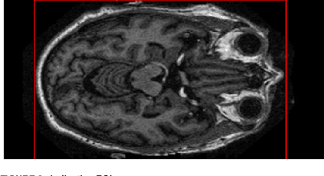 Figure 3 for Enhanced Deep Learning Methodologies and MRI Selection Techniques for Dementia Diagnosis in the Elderly Population