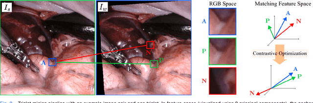 Figure 3 for Self-Supervised Contrastive Embedding Adaptation for Endoscopic Image Matching