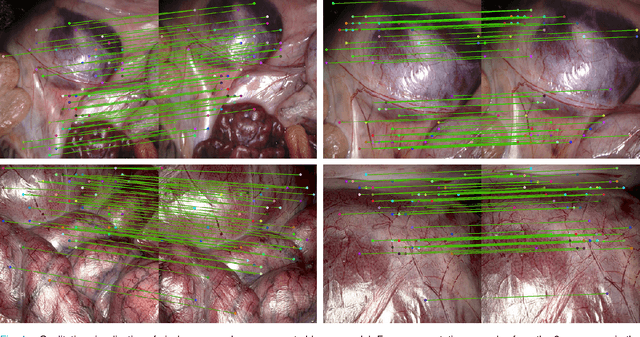 Figure 4 for Self-Supervised Contrastive Embedding Adaptation for Endoscopic Image Matching
