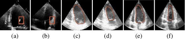 Figure 1 for GDKVM: Echocardiography Video Segmentation via Spatiotemporal Key-Value Memory with Gated Delta Rule