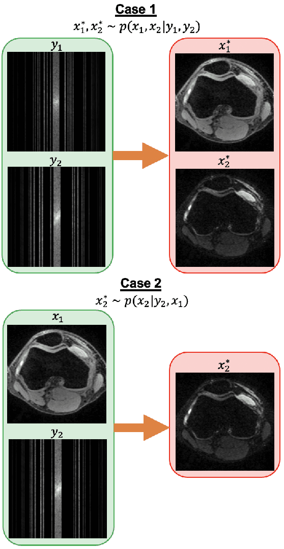 Figure 2 for Conditional Score-Based Reconstructions for Multi-contrast MRI