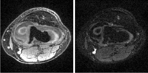 Figure 3 for Conditional Score-Based Reconstructions for Multi-contrast MRI