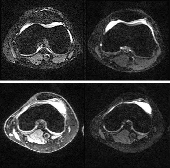 Figure 4 for Conditional Score-Based Reconstructions for Multi-contrast MRI