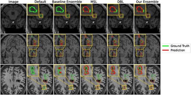 Figure 2 for Segmenting Small Stroke Lesions with Novel Labeling Strategies