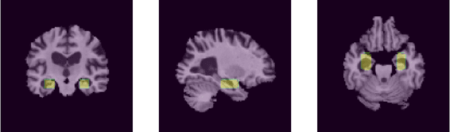 Figure 3 for iCBIR-Sli: Interpretable Content-Based Image Retrieval with 2D Slice Embeddings