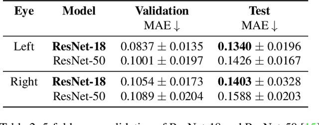 Figure 4 for EyeDentify: A Dataset for Pupil Diameter Estimation based on Webcam Images