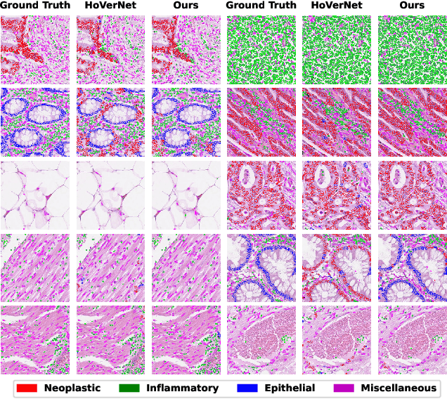 Figure 3 for HoVer-UNet: Accelerating HoVerNet with UNet-based multi-class nuclei segmentation via knowledge distillation