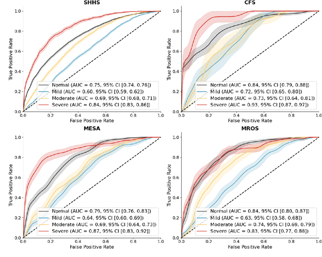 Figure 4 for Annotation of Sleep Depth Index with Scalable Deep Learning Yields Novel Digital Biomarkers for Sleep Health