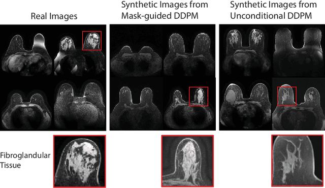 Figure 1 for Anatomically-Controllable Medical Image Generation with Segmentation-Guided Diffusion Models