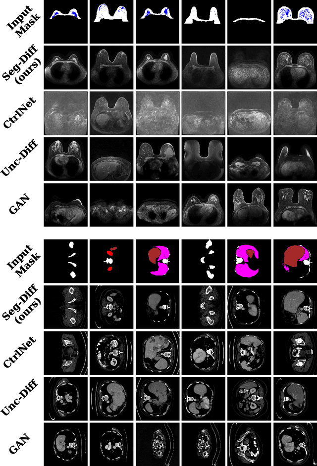 Figure 3 for Anatomically-Controllable Medical Image Generation with Segmentation-Guided Diffusion Models