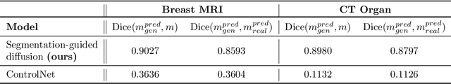 Figure 4 for Anatomically-Controllable Medical Image Generation with Segmentation-Guided Diffusion Models