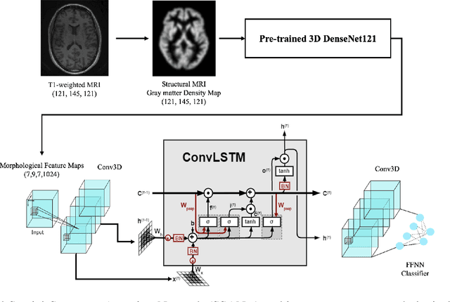 Figure 1 for Spatial Sequence Attention Network for Schizophrenia Classification from Structural Brain MR Images