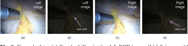 Figure 3 for Detecting the Sensing Area of A Laparoscopic Probe in Minimally Invasive Cancer Surgery