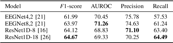 Figure 3 for Calibration-Free Driver Drowsiness Classification based on Manifold-Level Augmentation