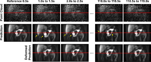 Figure 2 for Fast-MC-PET: A Novel Deep Learning-aided Motion Correction and Reconstruction Framework for Accelerated PET