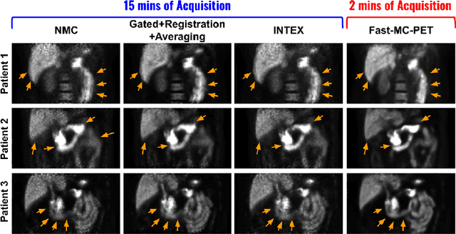 Figure 4 for Fast-MC-PET: A Novel Deep Learning-aided Motion Correction and Reconstruction Framework for Accelerated PET