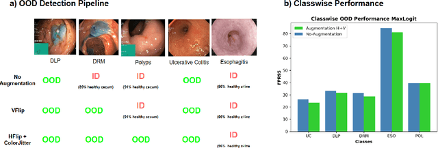 Figure 4 for TTA-OOD: Test-time Augmentation for Improving Out-of-Distribution Detection in Gastrointestinal Vision