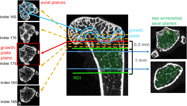 Figure 3 for MiceBoneChallenge: Micro-CT public dataset and six solutions for automatic growth plate detection in micro-CT mice bone scans