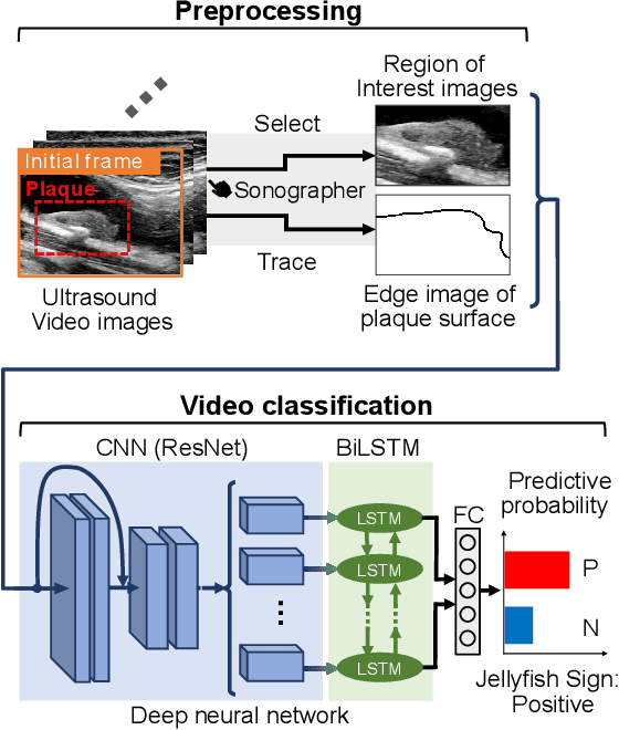 Figure 1 for Classification of Carotid Plaque with Jellyfish Sign Through Convolutional and Recurrent Neural Networks Utilizing Plaque Surface Edges