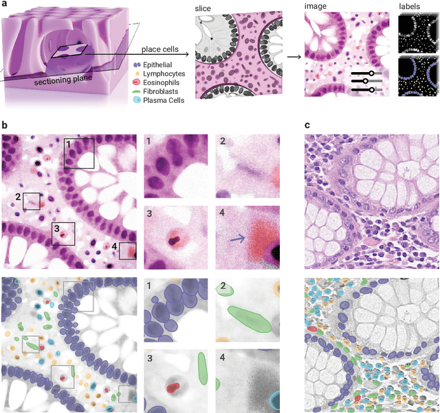 Figure 1 for Arctique: An artificial histopathological dataset unifying realism and controllability for uncertainty quantification