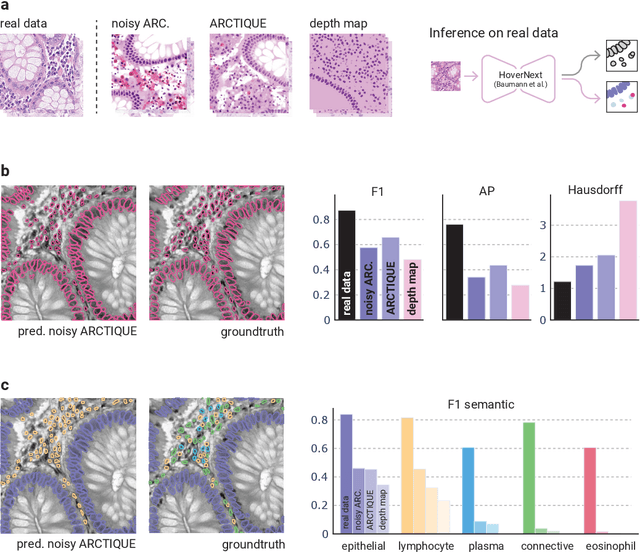 Figure 2 for Arctique: An artificial histopathological dataset unifying realism and controllability for uncertainty quantification