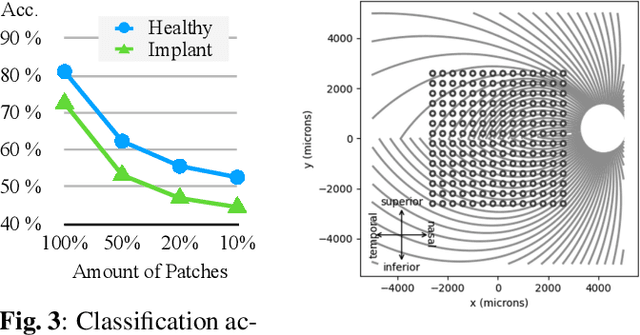 Figure 4 for Visual Fixation-Based Retinal Prosthetic Simulation