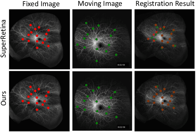 Figure 1 for RetinaRegNet: A Versatile Approach for Retinal Image Registration