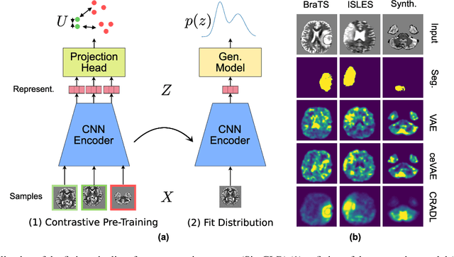 Figure 1 for CRADL: Contrastive Representations for Unsupervised Anomaly Detection and Localization
