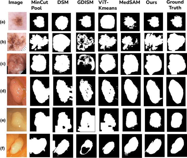 Figure 1 for UnSegGNet: Unsupervised Image Segmentation using Graph Neural Networks