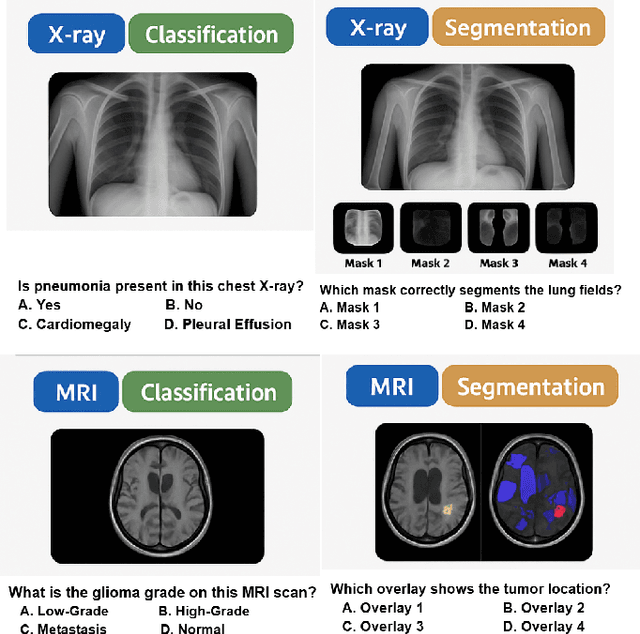 Figure 4 for CrossMed: A Multimodal Cross-Task Benchmark for Compositional Generalization in Medical Imaging