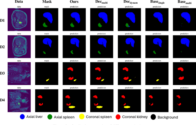 Figure 3 for MO-CTranS: A unified multi-organ segmentation model learning from multiple heterogeneously labelled datasets