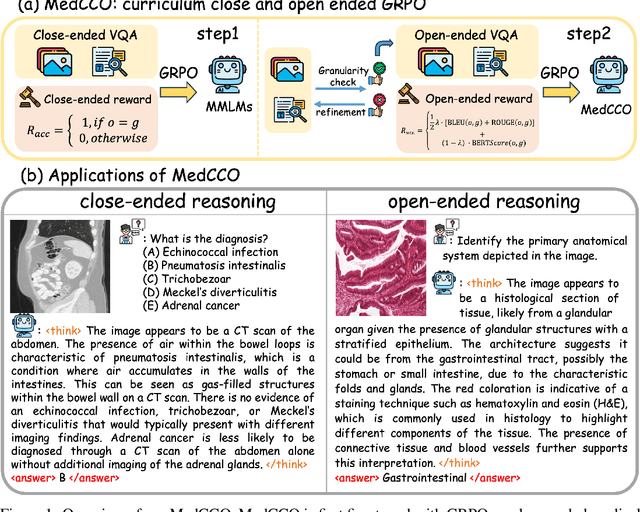 Figure 1 for Improving Medical Reasoning with Curriculum-Aware Reinforcement Learning