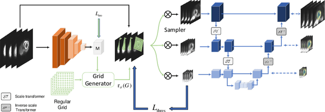 Figure 3 for A Multi-Scale Spatial Transformer U-Net for Simultaneously Automatic Reorientation and Segmentation of 3D Nuclear Cardiac Images