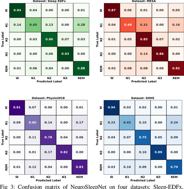 Figure 3 for NeuroSleepNet: A Multi-Head Self-Attention Based Automatic Sleep Scoring Scheme with Spatial and Multi-Scale Temporal Representation Learning