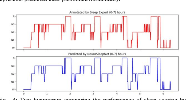 Figure 4 for NeuroSleepNet: A Multi-Head Self-Attention Based Automatic Sleep Scoring Scheme with Spatial and Multi-Scale Temporal Representation Learning