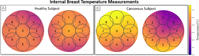 Figure 3 for Multi-Tiered Self-Contrastive Learning for Medical Microwave Radiometry (MWR) Breast Cancer Detection