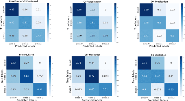 Figure 2 for Benchmarking Skeleton-based Motion Encoder Models for Clinical Applications: Estimating Parkinson's Disease Severity in Walking Sequences