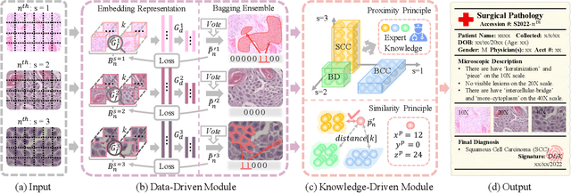 Figure 3 for Data and Knowledge Co-driving for Cancer Subtype Classification on Multi-Scale Histopathological Slides