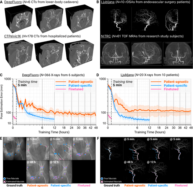 Figure 3 for Rapid patient-specific neural networks for intraoperative X-ray to volume registration
