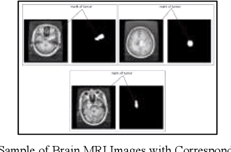 Figure 3 for Comparative Analysis of Image Enhancement Techniques for Brain Tumor Segmentation: Contrast, Histogram, and Hybrid Approaches