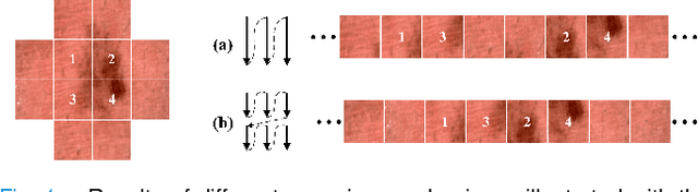 Figure 1 for SliceMamba for Medical Image Segmentation