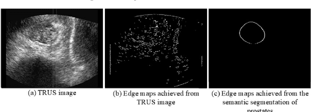 Figure 3 for 3D EAGAN: 3D edge-aware attention generative adversarial network for prostate segmentation in transrectal ultrasound images