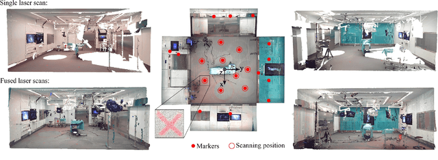 Figure 2 for Creating a Digital Twin of Spinal Surgery: A Proof of Concept