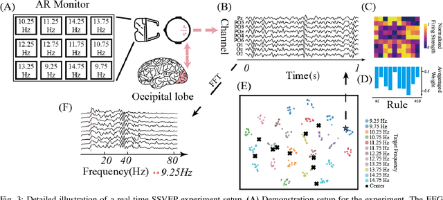 Figure 4 for iFuzzyTL: Interpretable Fuzzy Transfer Learning for SSVEP BCI System