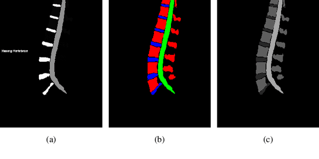 Figure 3 for Pioneering Precision in Lumbar Spine MRI Segmentation with Advanced Deep Learning and Data Enhancement