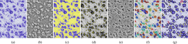 Figure 2 for MR-NOM: Multi-scale Resolution of Neuronal cells in Nissl-stained histological slices via deliberate Over-segmentation and Merging