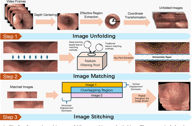 Figure 1 for Automatic Image Unfolding and Stitching Framework for Esophageal Lining Video Based on Density-Weighted Feature Matching